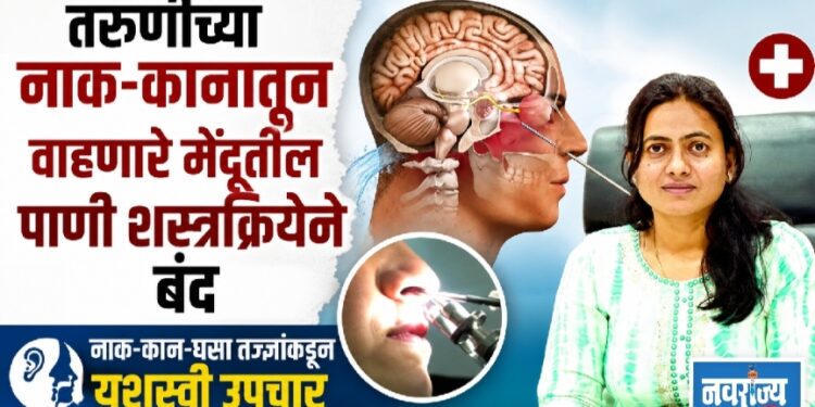 तरूणीच्या नाक-कानातून वाहणारे मेंदूतील पाणी शस्त्रक्रियेने बंद